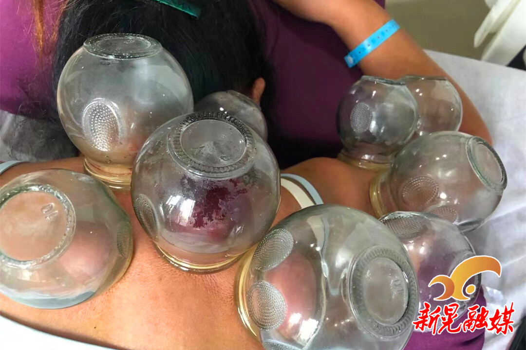 但治疗十余天后症状未见缓解。之后又多次在外院就诊，治疗效果均不佳。 拔罐治疗9月19日，患者入住县中