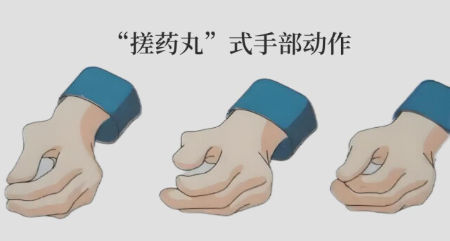世界帕金森日丨除了“手抖”，你對帕金森還了解多少？