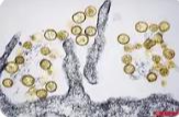 汉坦病毒在湖南有传播风险吗？疾控专家: 目前在我国和湖南输入风险很低
