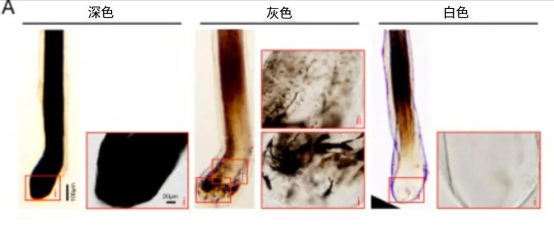 白头发别急着拔！试试这样做有望“由白转黑”