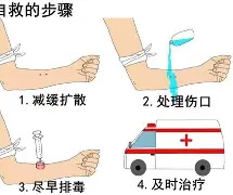 【健康科普】蛇咬伤急救误区多，急诊医生教你科学处理