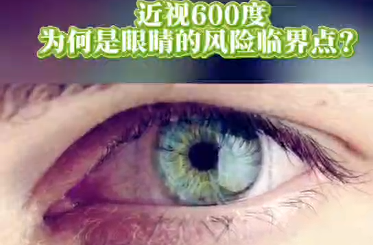 今日科普｜近视600度为何是眼睛的风险临界点？