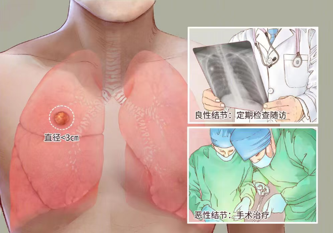 体检查出它别不在意 小心拖成癌！